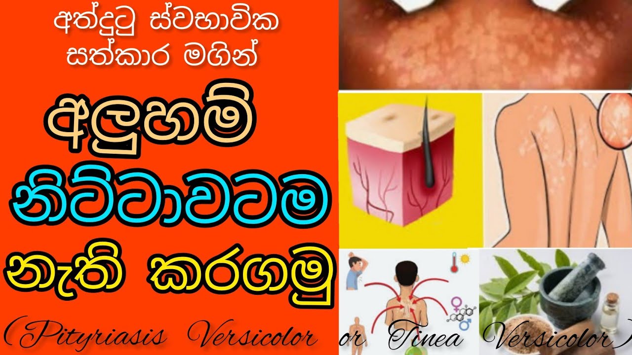 Aluham walata wisadum / hela secrets / sinhala /අලුහම් වලට බෙහෙත්