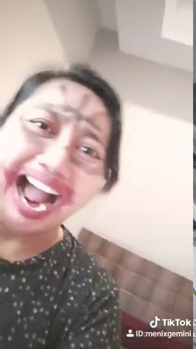 Tiktok Emergency - Iconapop