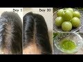 Amla juice Hair Oil for Double Hair Growth - Get Long Hair & turn thin hair to Thick Hair