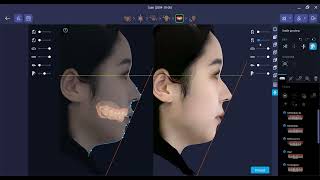 RAYFace Face Morphing screenshot 2