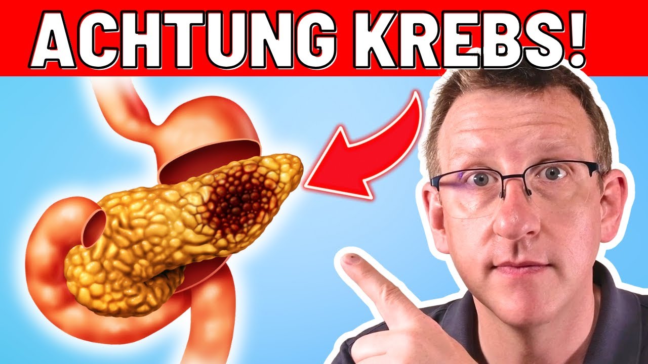 10 Frühwarnzeichen von Bauchspeicheldrüsenkrebs, die sofortiges Handeln erfordern!