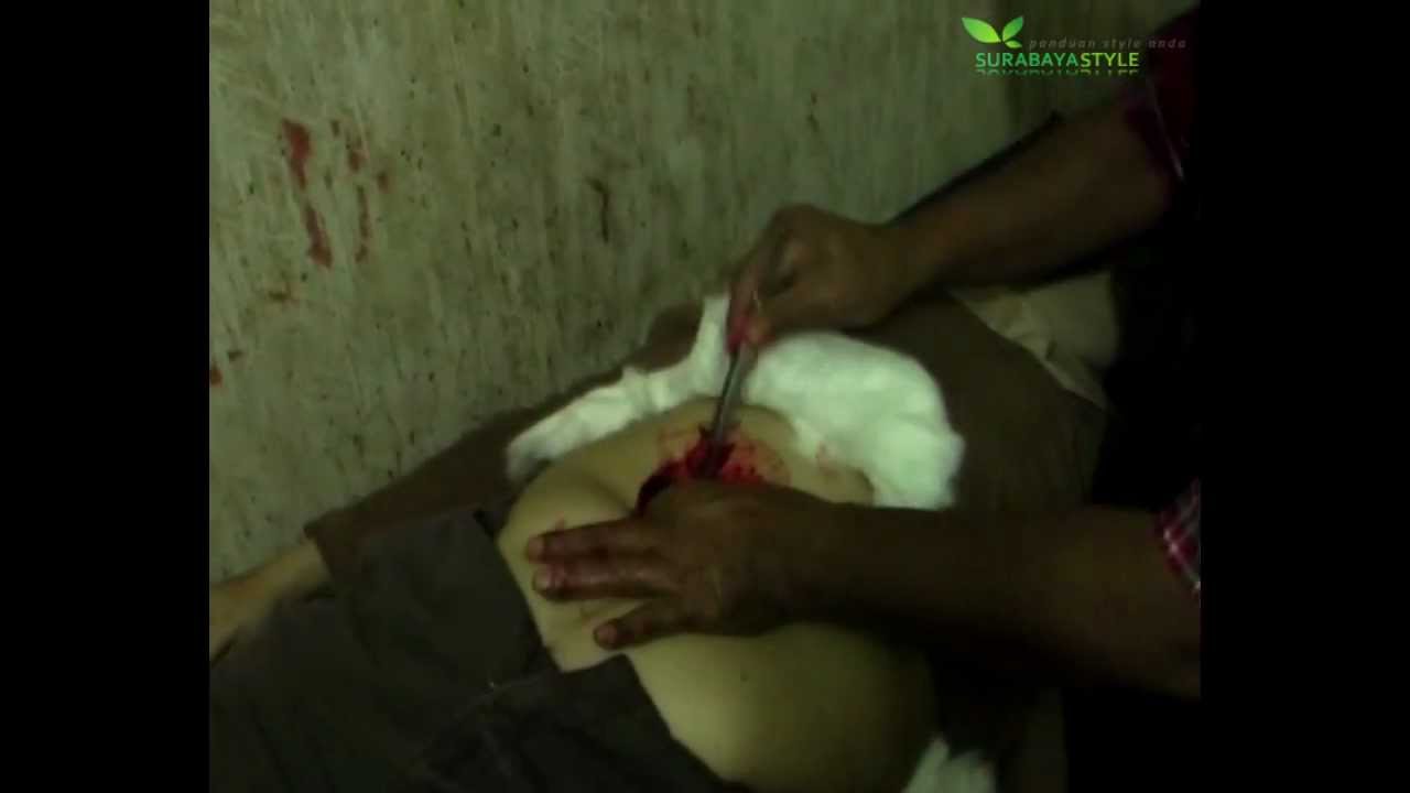 Damianus Wera Youtube