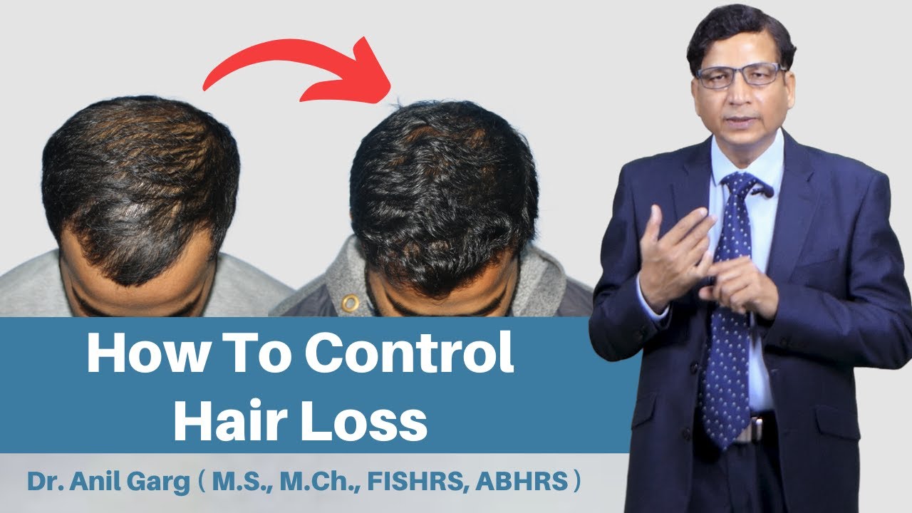 5 Tips On How To Stop Hair Loss And Regrow Hair Naturally How To 5-tips-on-how-to-stop-hair-loss-and-regrow-hair-naturally-how-to