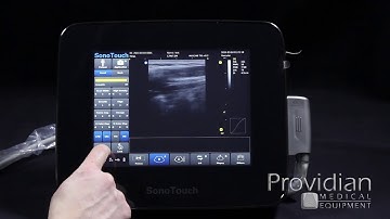 Chison SonoTouch 30 Part 3: 2D Imaging and Optimization; Ultrasound Training Series