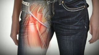 Tight Skinny Jeans Health Risk: Fashion Trend Might Cause Nerve Damage -  YouTube