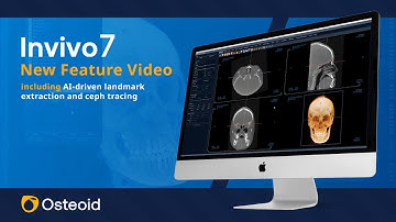 Invivo7.1 New Features