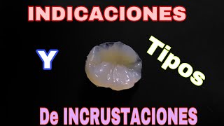 Que es una INCRUSTACIÓN DENTAL (molares DESTRUIDOS por CARIES)