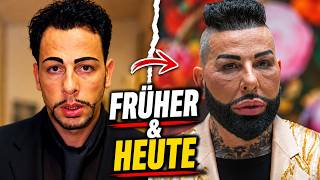20 Deutsche Promis, die früher wunderschön waren – heute kaum wiederzuerkennen!
