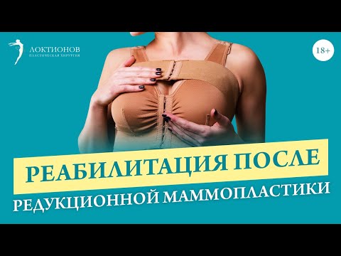 Как восстановиться после уменьшения груди? Важные аспекты / 18+