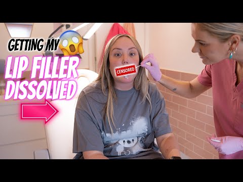 Getting my LIP FILLER DISSOLVED (SHOCKED) | Charlotte Crosby