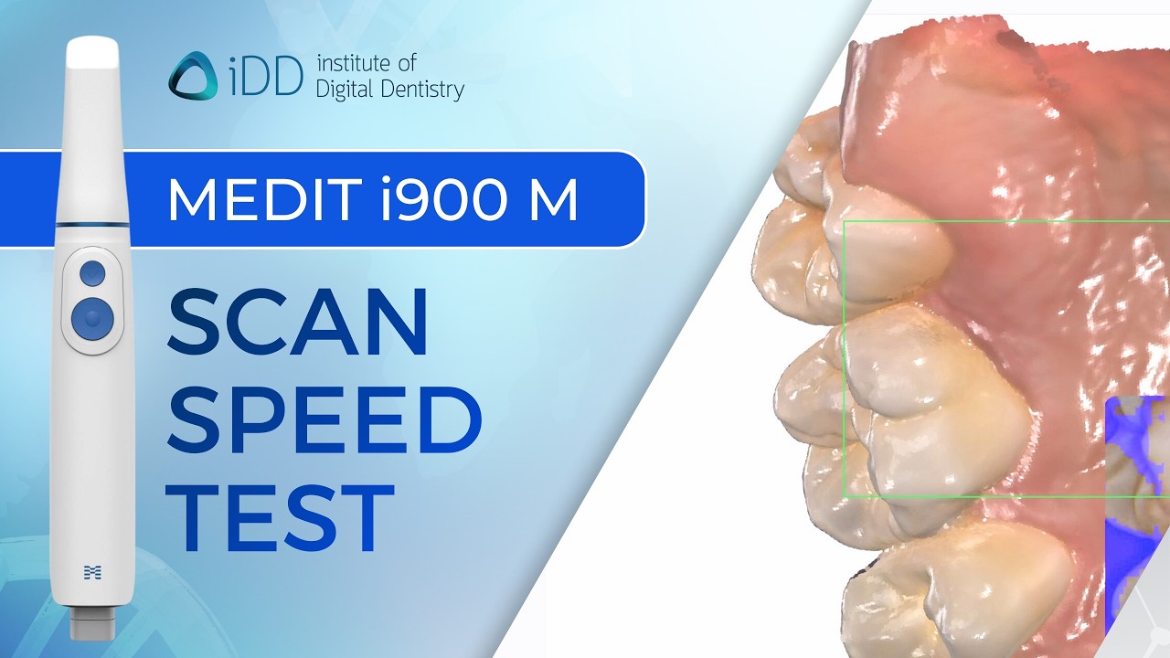 Medit i900 Mobility Speed Test - How Fast Is iPad Scanning? | iDD - YouTube