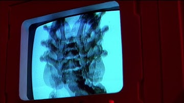 AVP 2 - Life Cycle is on