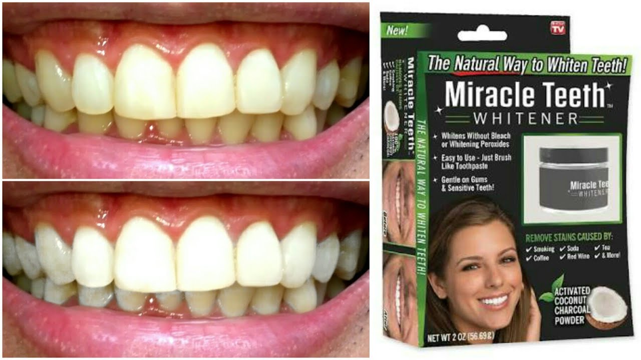 miracle teeth whitener price