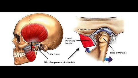 Arthroplasty Temporomandibular joint CPT code - simplify medical coding