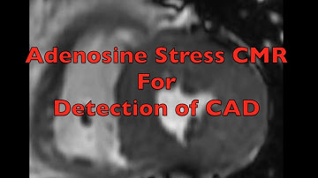 Adenosine stress CMR for Detection of CAD
