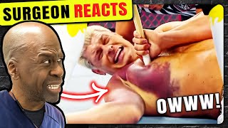 20 Minutes Of Insane WWE Injuries | Surgeon Reacts