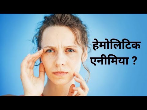 वीडियो: हेमोलिटिक एनीमिया किसे हो जाता है?