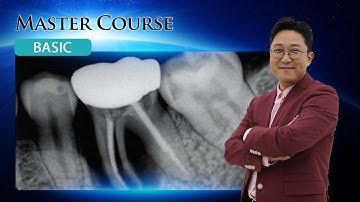 [Master Course - BASIC] Determination and Strategy of Implant Placement after Extraction PART 2