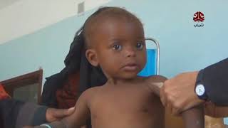 سوء التغذية يهدد اطفال الضالع | تقرير عبدالعزيز الليث