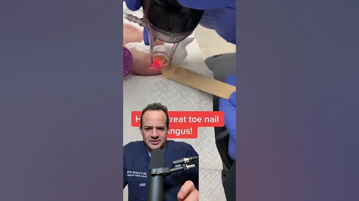 TOENAIL FUNGUS? DON’T DO THIS!?😱 #shorts