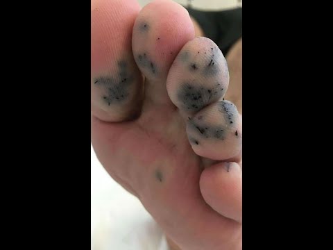 ابو الهيلمان يسبب الزعر في شواطئ العقبة 2020تعرف على حقيقة انتشارابو الهيلمان داخل مياه العقبة