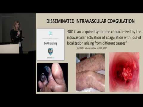 Video: Sistem De Trombomodulină / Proteină C Activată în Coagulare Intravasculară Diseminată în Sept