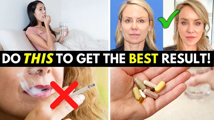 5 Things you MUST do to prepare for your Facelift Surgery!