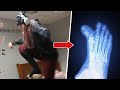 HOW I BROKE MY FOOT