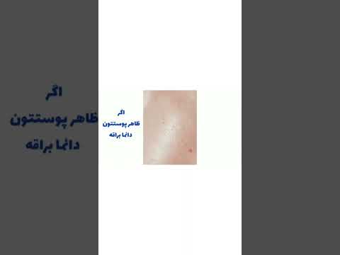 مراقبت  محصولات پوستی زیبایی