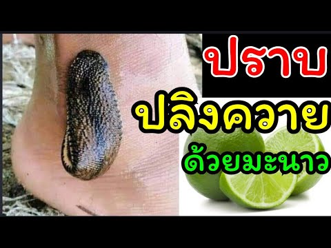 ทำไงดีเมื่อเจอปลิงควายกัด!…ทำไงดี | สรุปเนื้อหาที่เกี่ยวข้องกับปลิงกลัวอะไรที่อัปเดตใหม่