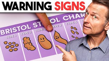 Does Your Poop Look Like This?  (Signs You’re NOT Healthy)
