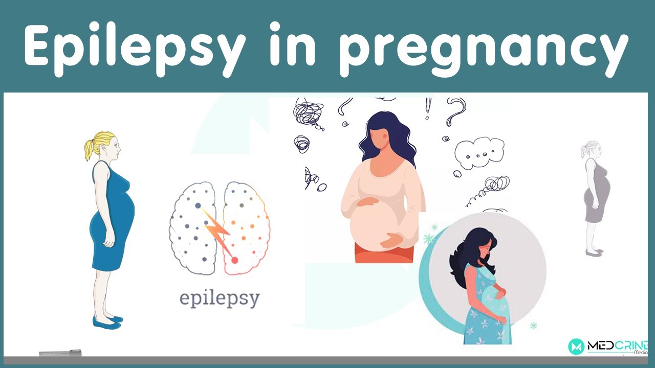Epilepsy In Pregnancy Causes Risks And Management YouTube