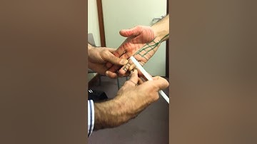 5. UL Ulnar nerve - Course