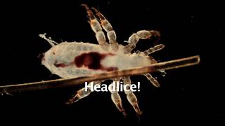 Head Lice Microscopic View!