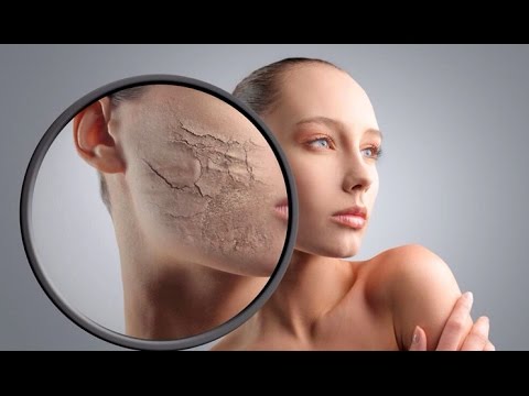 Video: Մաշկի սպիտակեցումը լավ է, թե վատ:
