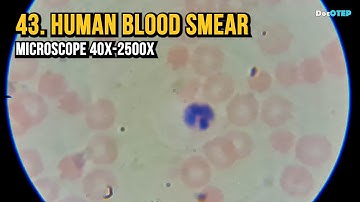 43. Human Blood Smear (Microscope 40x-2500x)