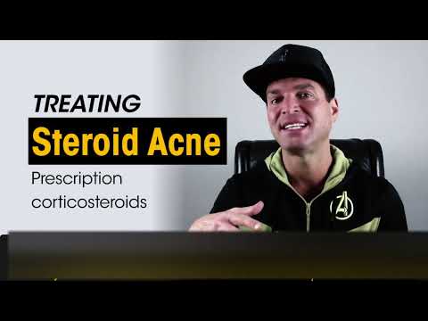 Treating Steroid Acne Explained:  By Dylan Gemelli