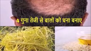 Hair Growth Home Remedies For Women Amarbel Plant