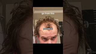 Utilise Lhuile De Romarin Correctement