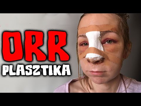 Videó: Előtte és Utána: A 