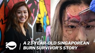 Living As A Burn Survivor: Charlene Chew's Story