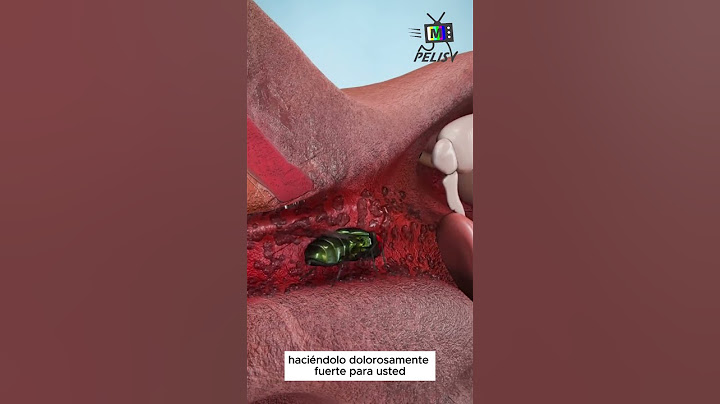 Por qué a los insectos les gusta tu canal auditivo 😱