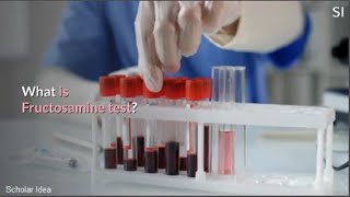 What is Fructosamine test