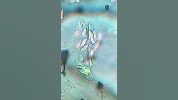 Banana starch under the microscope 🔬 #microscope #science #banana #shorts #research