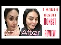 Ryx rejuvenating starter kit (UPDATE) 1month result