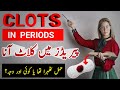 Clots In Periods Periods Or Miscarriage Heavy Periods With Blood Clots Implantation Failure Clots In Periods Periods Or Miscarriage Heavy Periods With Blood Clots Implantation Failure