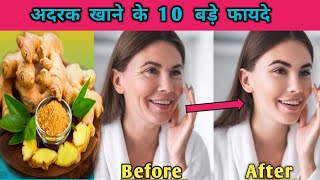 GINGER Top 10 Amazing Health Benefits अदरक के चमत्कार फायदे