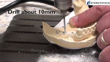Guided surgery + CBCT radiopaque guide: How to drill a stone model