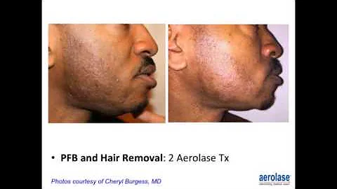 Skin Rejuvenation in Skin of Color and Photodamage...
