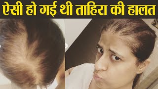 Tahira Kashyap shares emotional post after cancer treatment | Boldsky